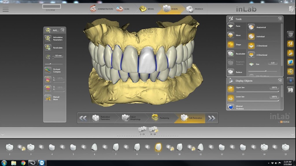 Creative Image Dental Laboratory | 449 W Allen Ave #109, San Dimas, CA 91773, USA | Phone: (909) 305-0900