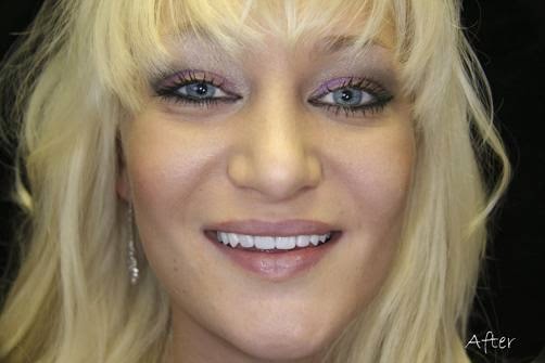 1st Smile Dental Care | 3626 N MacArthur Blvd # 235, Irving, TX 75062, USA | Phone: (214) 736-3777 1st Smile Dental Care | 3626 N MacArthur Blvd # 235, Irving, TX 75062, USA | Phone: (214) 736-3777