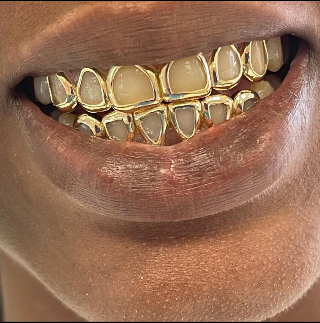 Gold Teeth Master | 3503 E Hillsborough Ave B, Tampa, FL 33610, USA | Phone: (813) 997-9247