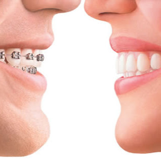 Happy Braces Orthodontics, La Mirada - dentist  | Photo 9 of 10 | Address: 12271 La Mirada Blvd #202, La Mirada, CA 90638, USA | Phone: (562) 944-8877