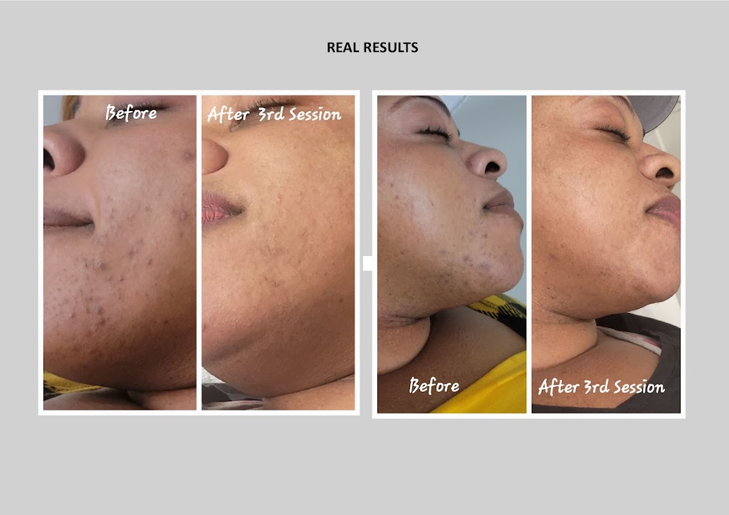 Isabels Esthetic | Hoffner Office Center, 5448 Hoffner Ave Suite 105, Orlando, FL 32812, USA | Phone: (407) 203-1800