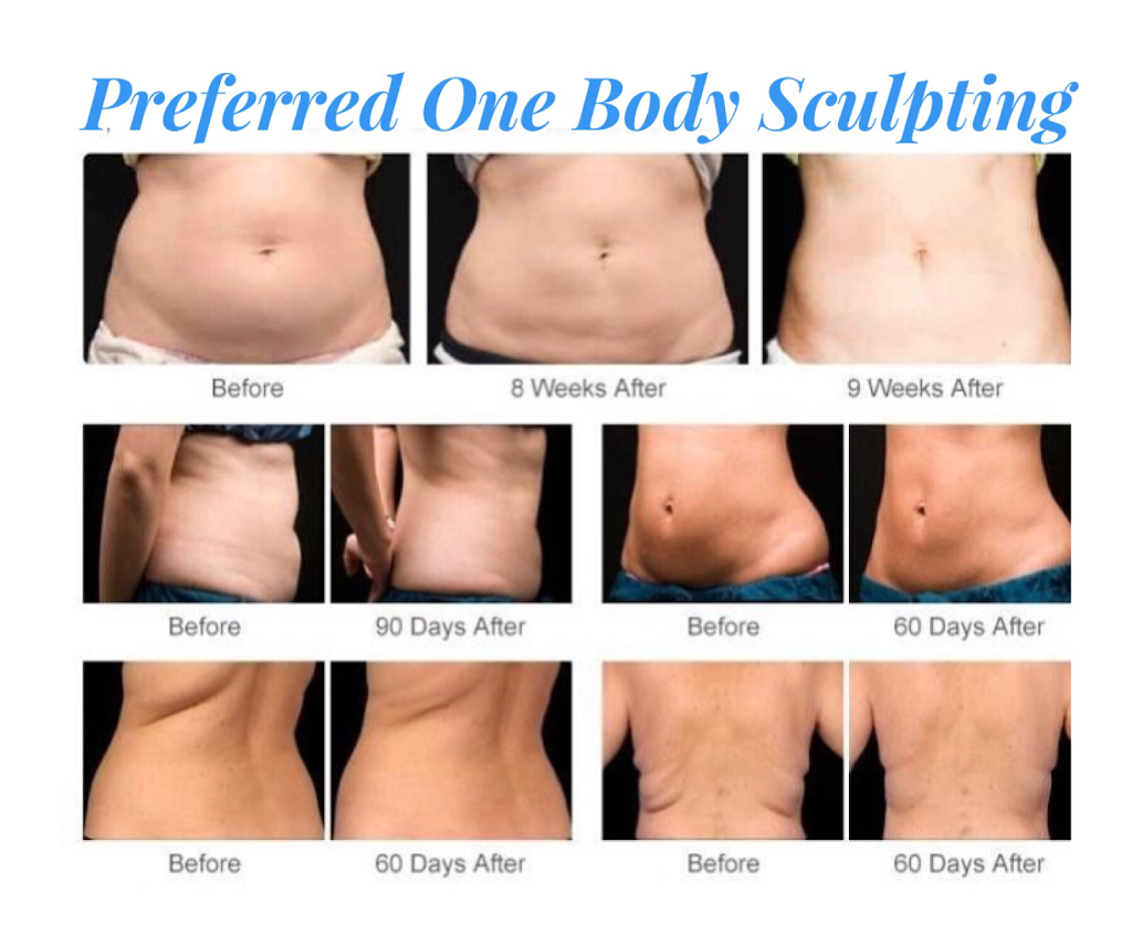 Preferred One Body Sculpting | 8450 Chapel Hill Rd Suite 201, Cary, NC 27513, USA | Phone: (919) 428-4164