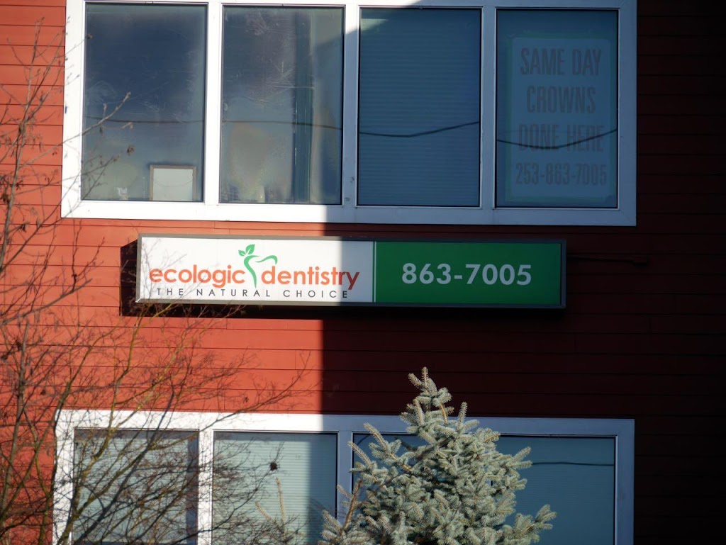 Ecologic Dentistry | 8412 Myers Rd E # 301, Bonney Lake, WA 98391, USA | Phone: (253) 863-7005