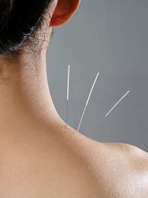 Nashville Acupuncture Clinic | 7980 Coley Davis Road Suite, Office Condominium Suites, 102 Harpeth Springs Dr, Nashville, TN 37221, USA | Phone: (615) 692-8248