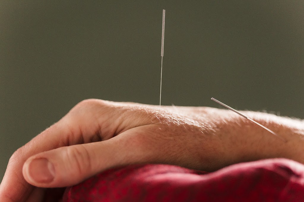 Classical Acupuncture Clinic | 150 Iowa Ln Suite 101, Cary, NC 27511, USA | Phone: (919) 395-2291