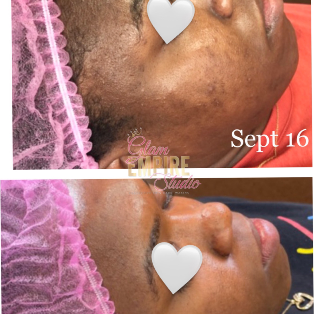Glam Empire Studio LLC- Corrective Skin Care & Waxing | 213 Old Padonia Rd #2, Cockeysville, MD 21030, USA | Phone: (443) 826-0846