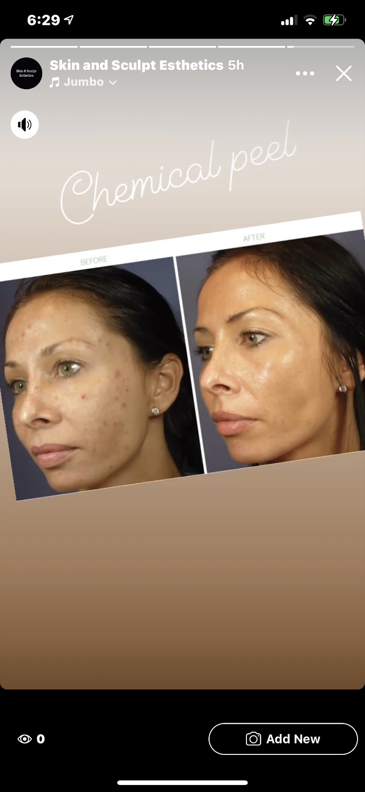 Skin and Sculpt Esthetics | 10506 Greenbriar Ln, Rowlett, TX 75089, USA | Phone: (972) 748-6005