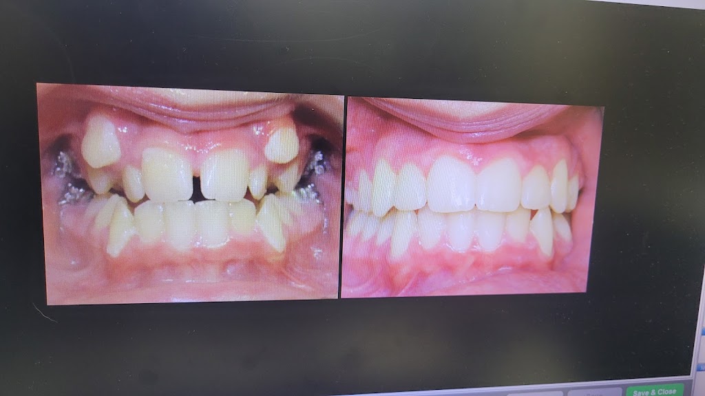 Restoration Orthodontics | 8255 Anchor Dr, Windsor, ON N8N 5G1, Canada | Phone: (519) 948-2471