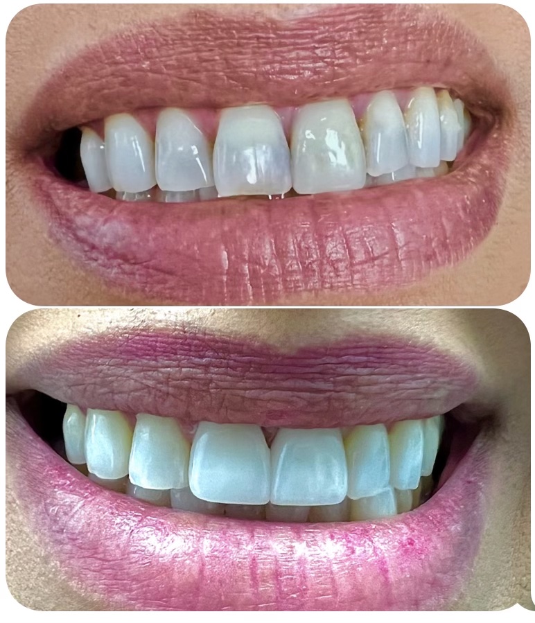 Smile Essentials Dental Care | 1850 University Dr #120, Vista, CA 92083, USA | Phone: (760) 806-5302