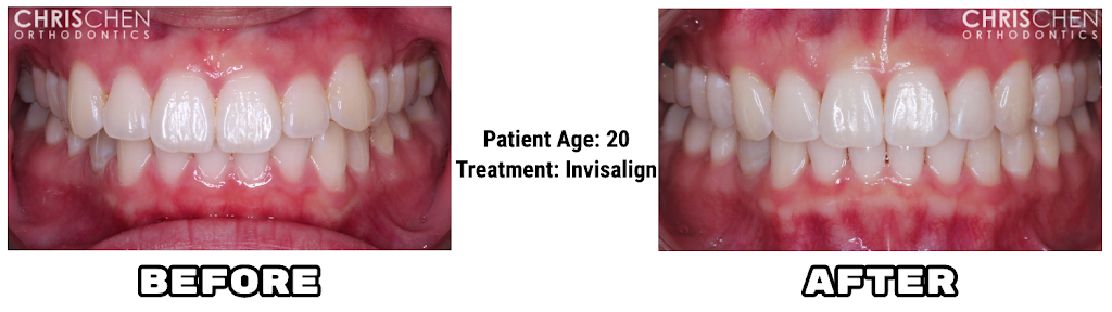 Chris Chen Orthodontics - Braces and Invisalign - dentist  | Photo 4 of 4 | Address: 19217 Colima Rd #B, Rowland Heights, CA 91748, USA | Phone: (626) 581-9100