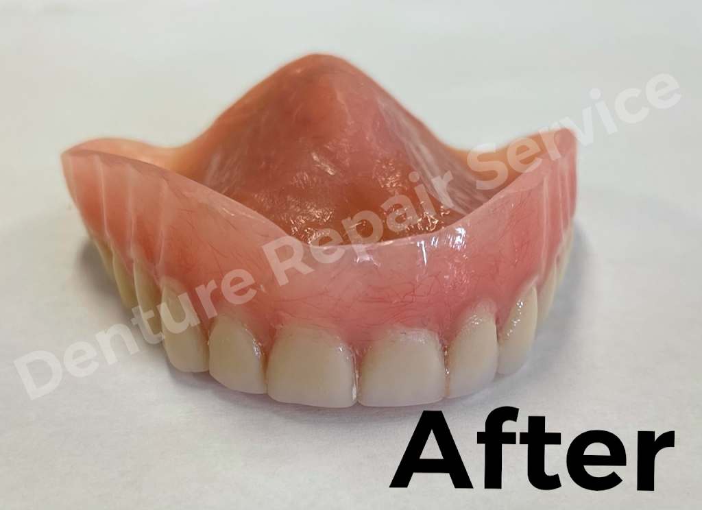 Denture repair service | second floor, 2030 W Lincoln Ave suite i, Anaheim, CA 92801, USA | Phone: (949) 447-6000