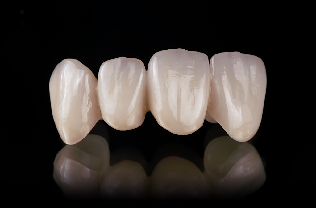 MicroDental Las Vegas Laboratory | 1401 Hillshire Dr # 110, Las Vegas, NV 89134, USA | Phone: (702) 458-1079