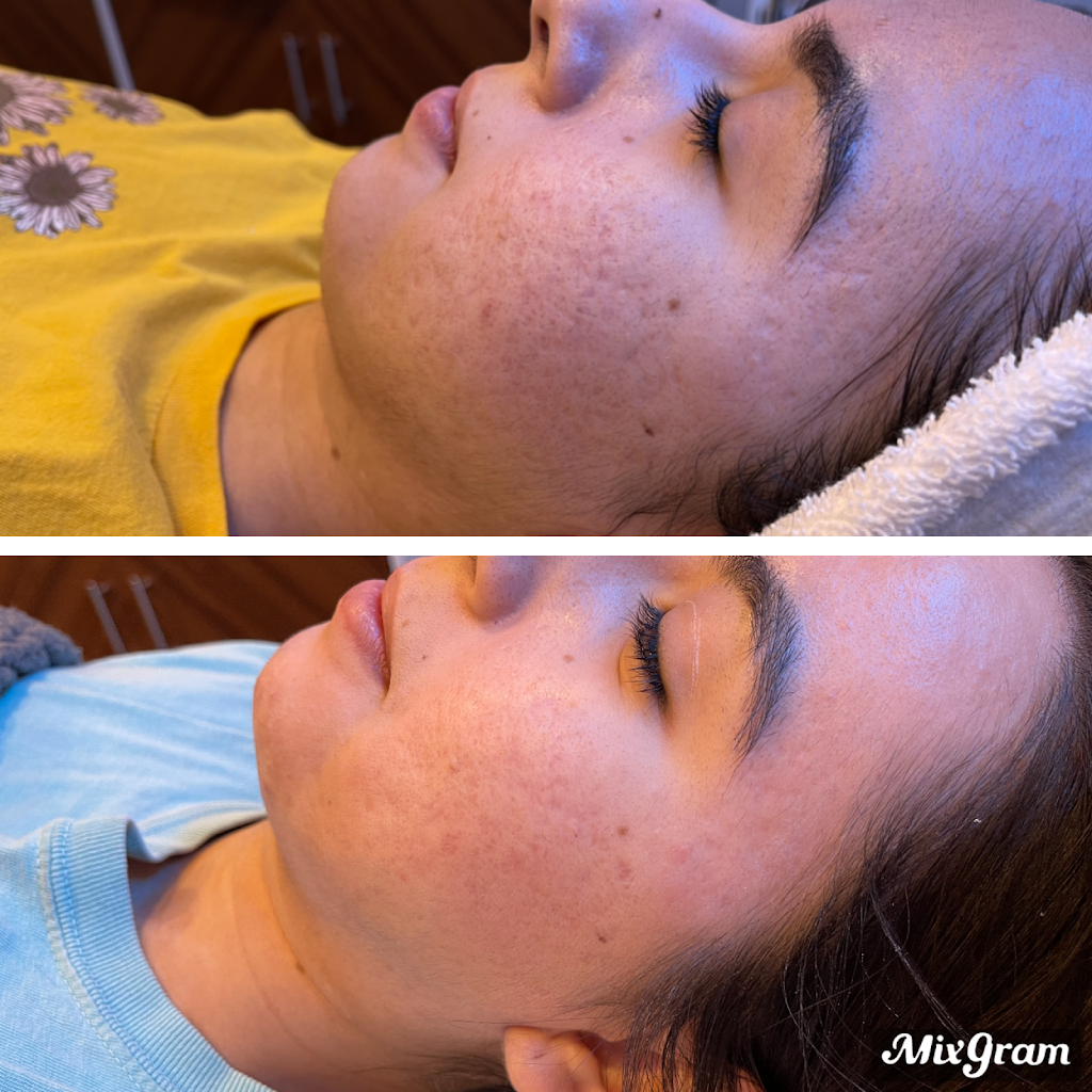 Skin By Kaitlyn | 5801 Long Prairie Rd Suite 46, Flower Mound, TX 75028, USA | Phone: (469) 993-4310