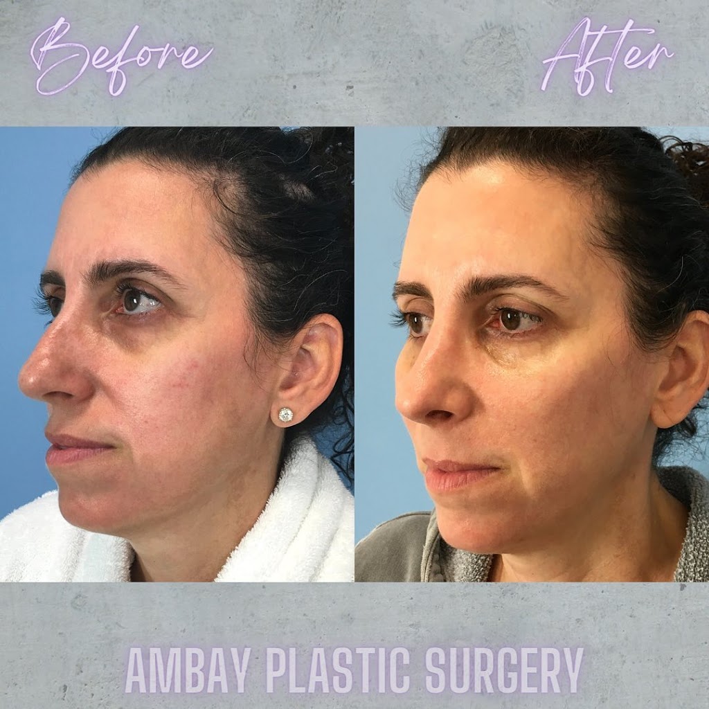 Ambay Plastic Surgery | 2441 Oak Myrtle Ln Suite 102, Wesley Chapel, FL 33544, USA | Phone: (813) 406-4448