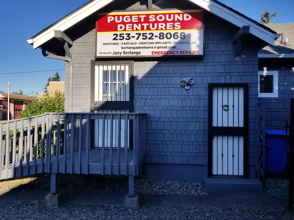 Berlanga Dentures | 601 N Puget Sound Ave, Tacoma, WA 98406, USA | Phone: (253) 752-8068