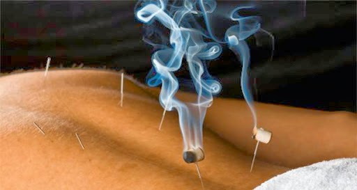 Blue Serenity Acupuncture | 4727 E Bell Rd Ste 45427, Phoenix, AZ 85032, USA | Phone: (480) 559-9744