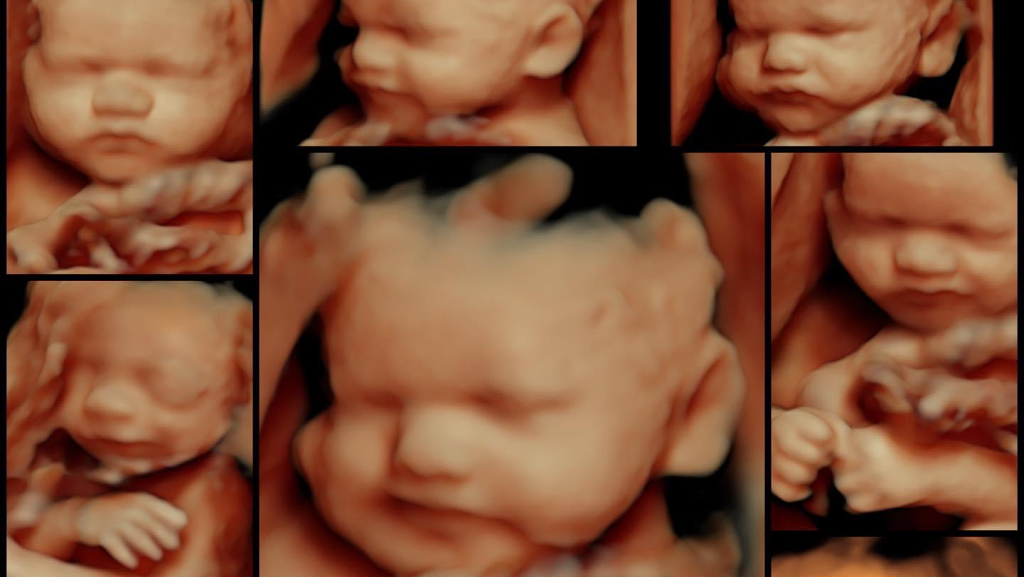 First Expressions Ultrasound | 1725 Gateway Cir, Grove City, OH 43123, USA | Phone: (614) 895-2229