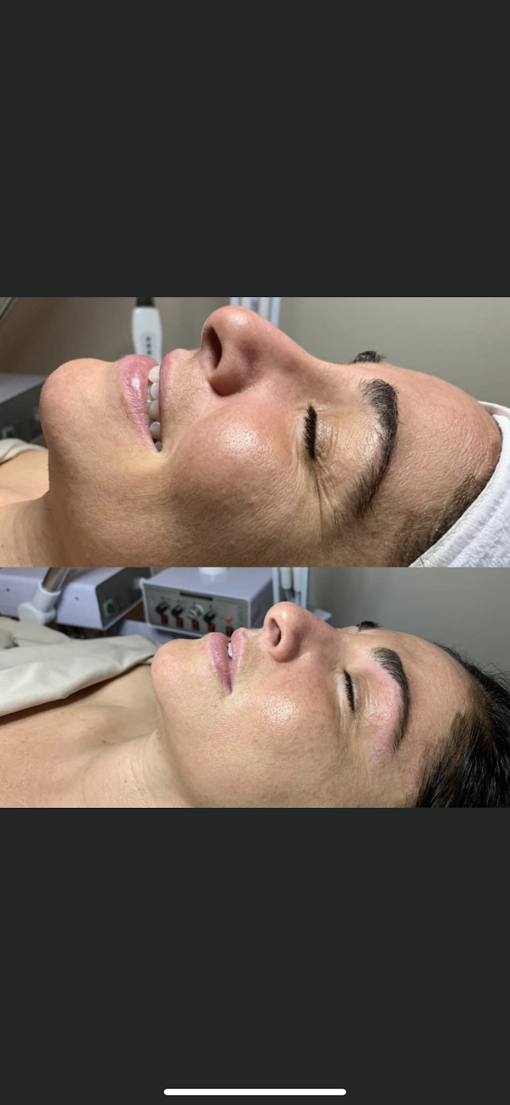 Skincare by Analisa | 24710 Washington Ave #3, Murrieta, CA 92562, USA | Phone: (951) 375-9197