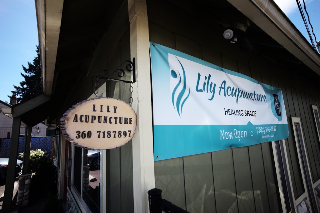 Lily Acupuncture Healing Space | 1912 Grand Blvd, Vancouver, WA 98661, USA | Phone: (360) 718-7897