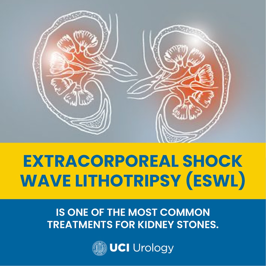 UCI Urology | Yorba Linda | 18637 Yorba Linda Blvd, Yorba Linda, CA 92886, USA | Phone: (877) 503-7457