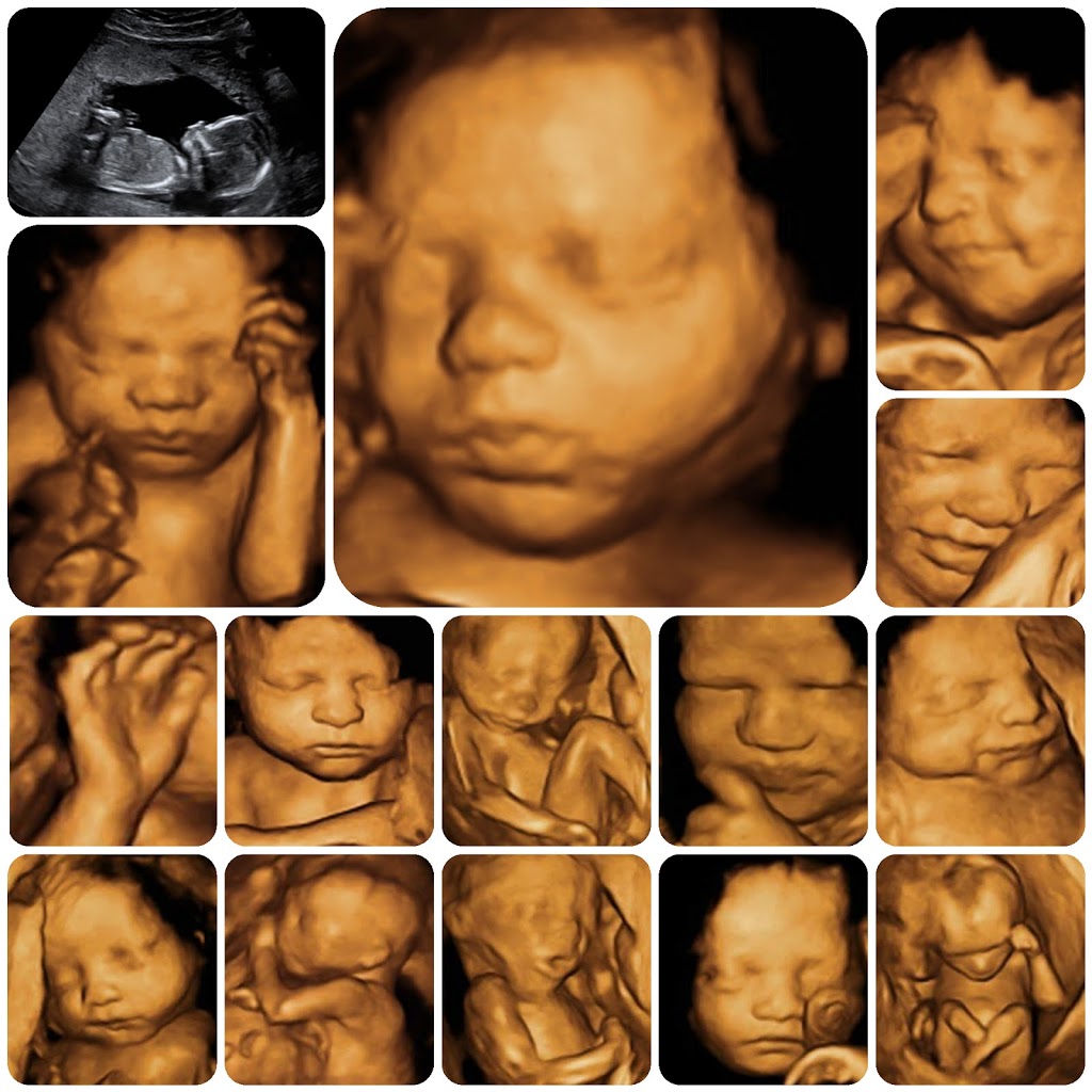 Prenatal Premiere Ultrasound | 3126 S Higley Rd #104, Gilbert, AZ 85295, USA | Phone: (480) 300-9724