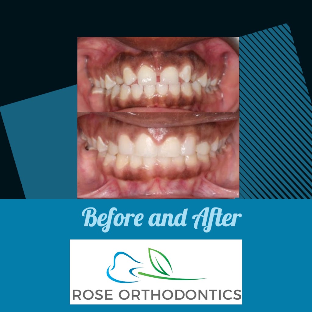 Rose Orthodontics: Aaron Rose, DMD, MS | 980 W Central Ave Suite D, Delaware, OH 43015 | Phone: (740) 272-4455