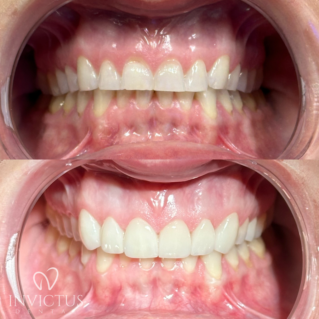 Invictus Modern Dentistry | 2521 Palomar Airport Rd Suite 102, Carlsbad, CA 92011, USA | Phone: (858) 744-3588