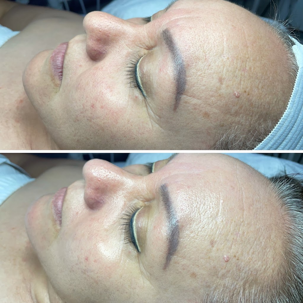 Rejuvenating Skin Studio LLC | 143 E Germann Rd Room 206, Gilbert, AZ 85297, USA | Phone: (480) 643-9750