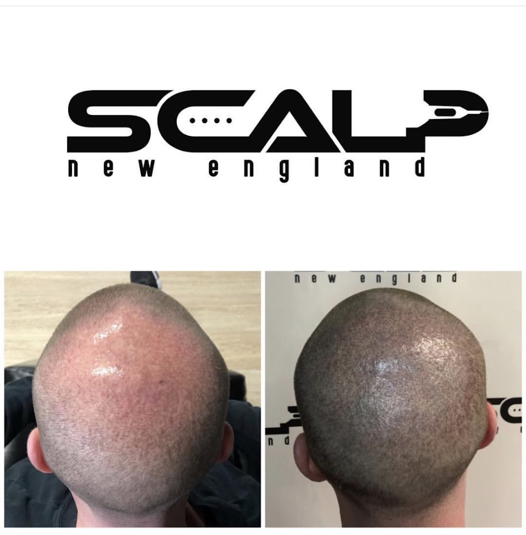 Scalp New England | 2 1st Avenue Door 103, suite 104-3, Peabody, MA 01960, USA | Phone: (978) 381-8075