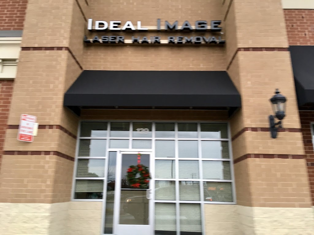 Ideal Image Richmond | 11331 W Broad St #129, Glen Allen, VA 23060, USA | Phone: (804) 621-0171