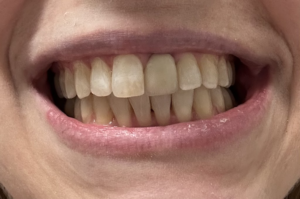 Family Orthodontics of Hudson | 118 Forest Ave # 202, Hudson, MA 01749, USA | Phone: (978) 562-1234