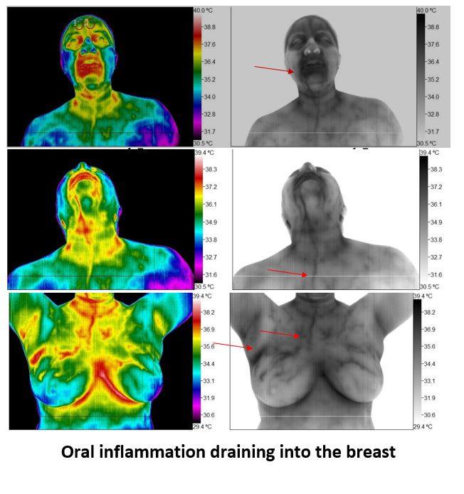 De Novo Scan, Clinical Thermography | 5949 E University Dr, Mesa, AZ 85205 | Phone: (480) 284-2222