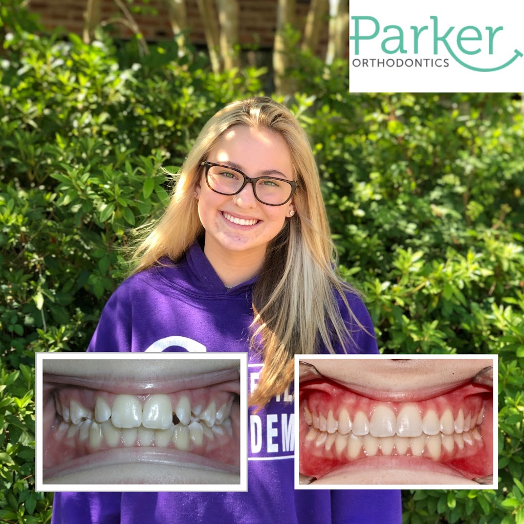 Parker Orthodontics | 16606 Greenwell Springs Rd, Greenwell Springs, LA 70739, USA | Phone: (225) 923-2060