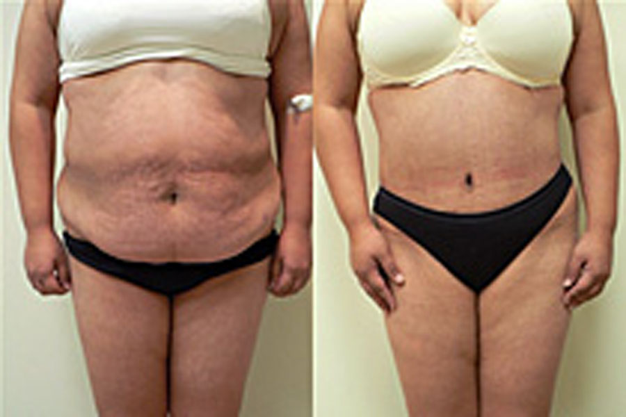 Glenn Herrmann MD | 130 Old Laramie Trail E, Lafayette, CO 80026, USA | Phone: (303) 664-9400