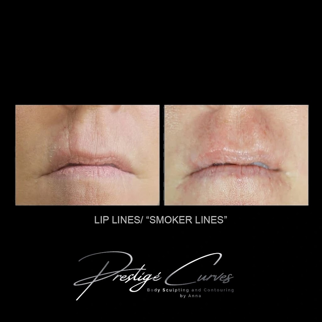 Prestigé Curves Body Sculpting | 520 W Lacey Blvd #3, Hanford, CA 93230, USA | Phone: (559) 904-9943
