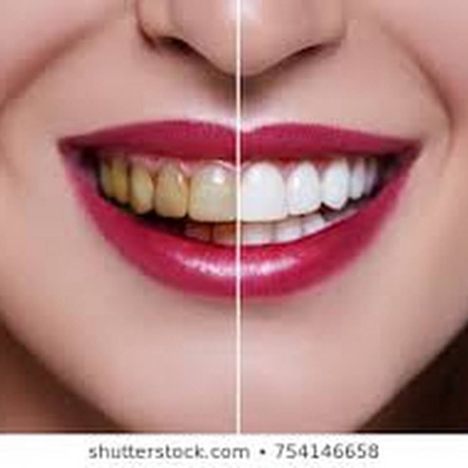 Family And Cosmetic Dentistry | 756 Madison Ave, Albany, NY 12208, USA | Phone: (518) 427-2808