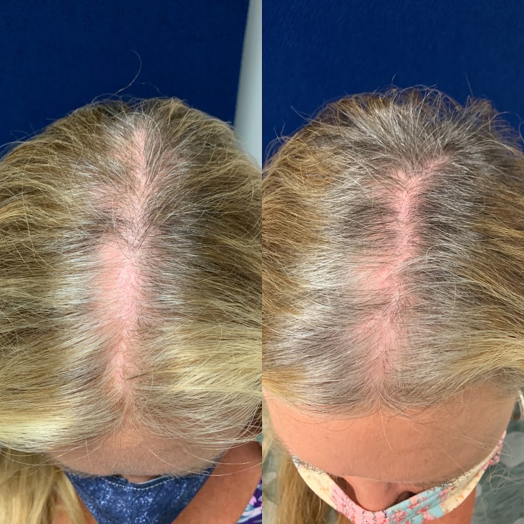 Hair Loss Solutions of Newport Beach | 1501 Westcliff Dr, Newport Beach, CA 92660, USA | Phone: (949) 503-9621