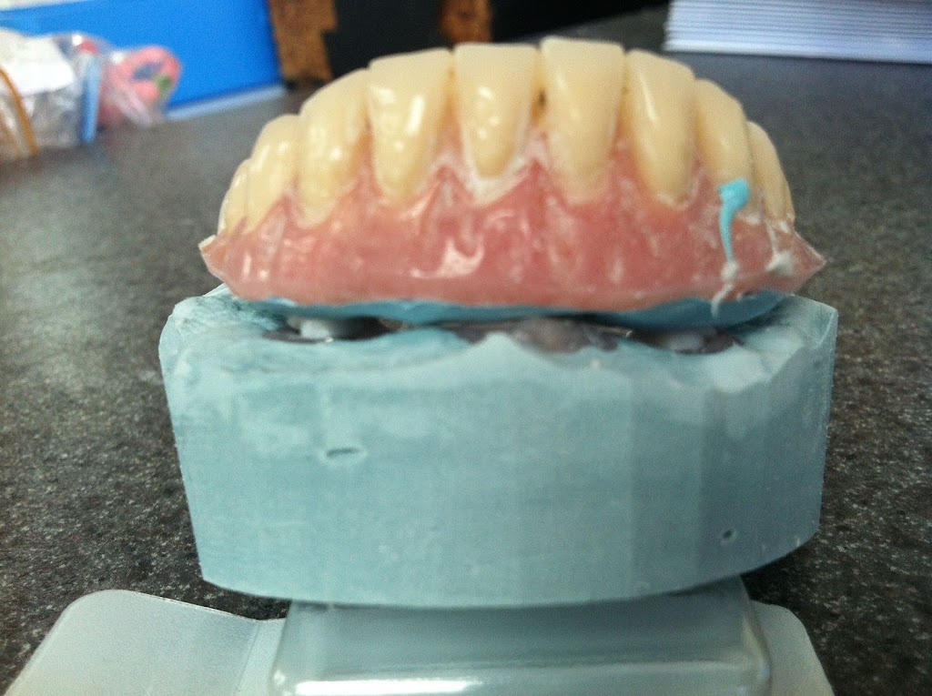 Precision Dental Prosthetics | 23021 N 15th Ave #205, Phoenix, AZ 85027, USA | Phone: (602) 485-7845