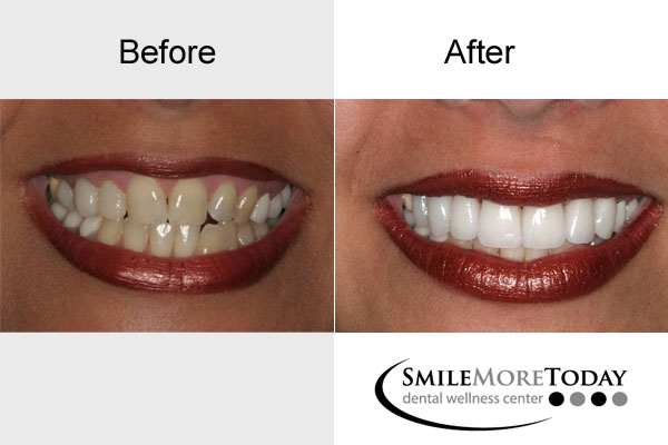 Smile More Today | 250 Center Dr #202, Vernon Hills, IL 60061 | Phone: (847) 247-1700