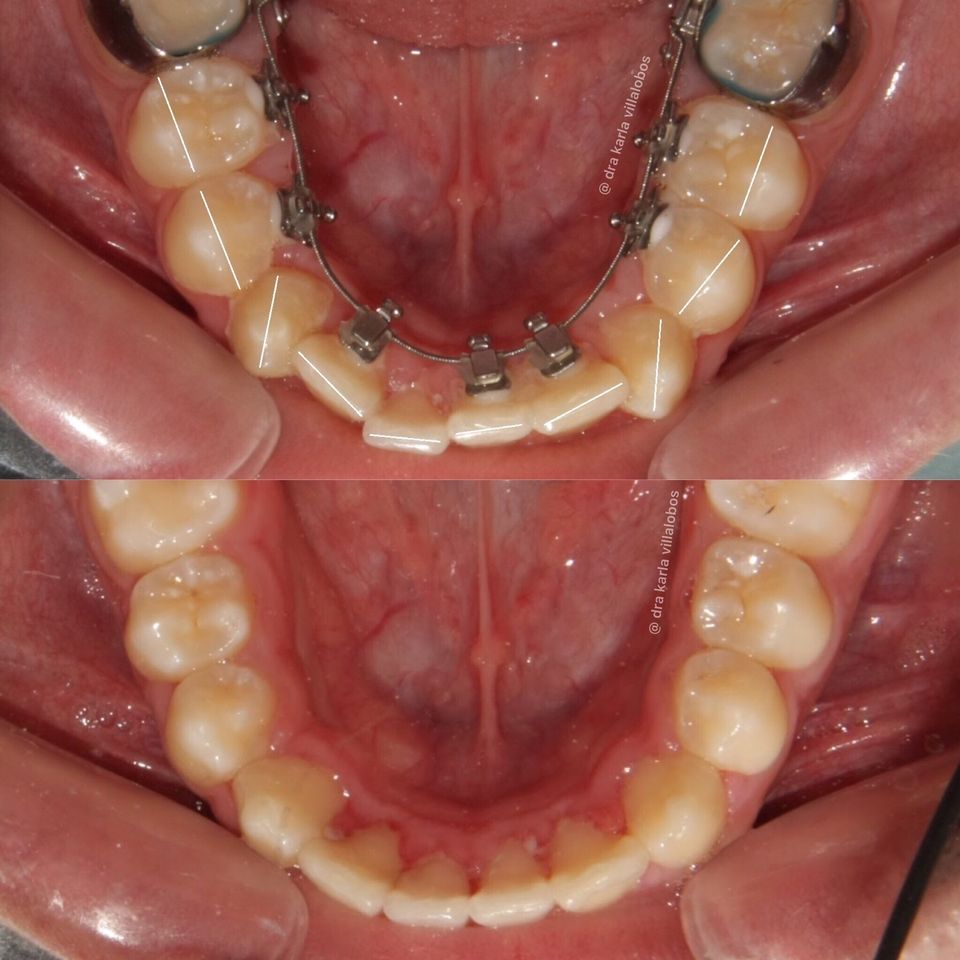 Implantes dentales en Tijuana - DENTOK México | Diego Rivera 2311-Int. 404, Zona Urbana Rio Tijuana, 22010 Tijuana, B.C., Mexico | Phone: 664 630 5194