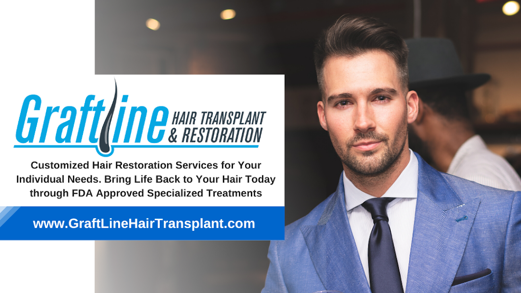 Graft Line Hair Transplant & Restoration | 4817 W 83rd St #2, Burbank, IL 60459 | Phone: (708) 307-6245