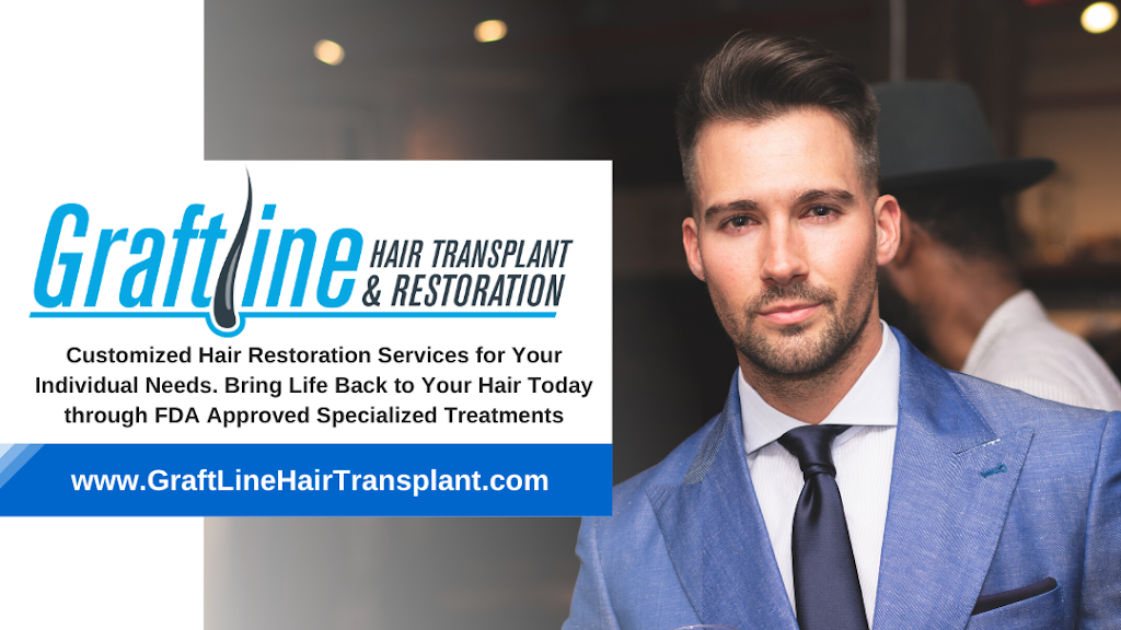 Graft Line Hair Transplant & Restoration | 4817 W 83rd St #2, Burbank, IL 60459, USA | Phone: (708) 307-6245