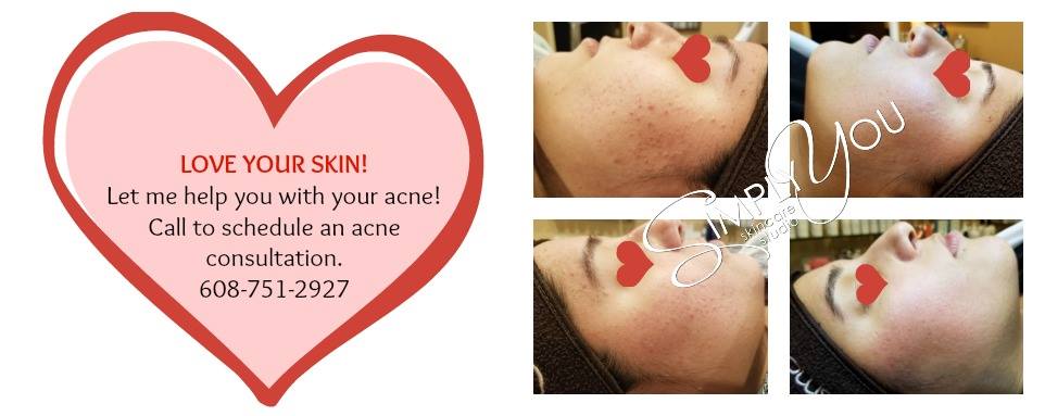 Simply You Skincare Studio | 5340 N Sweetbriar Dr, Milton, WI 53563, USA | Phone: (608) 751-2927