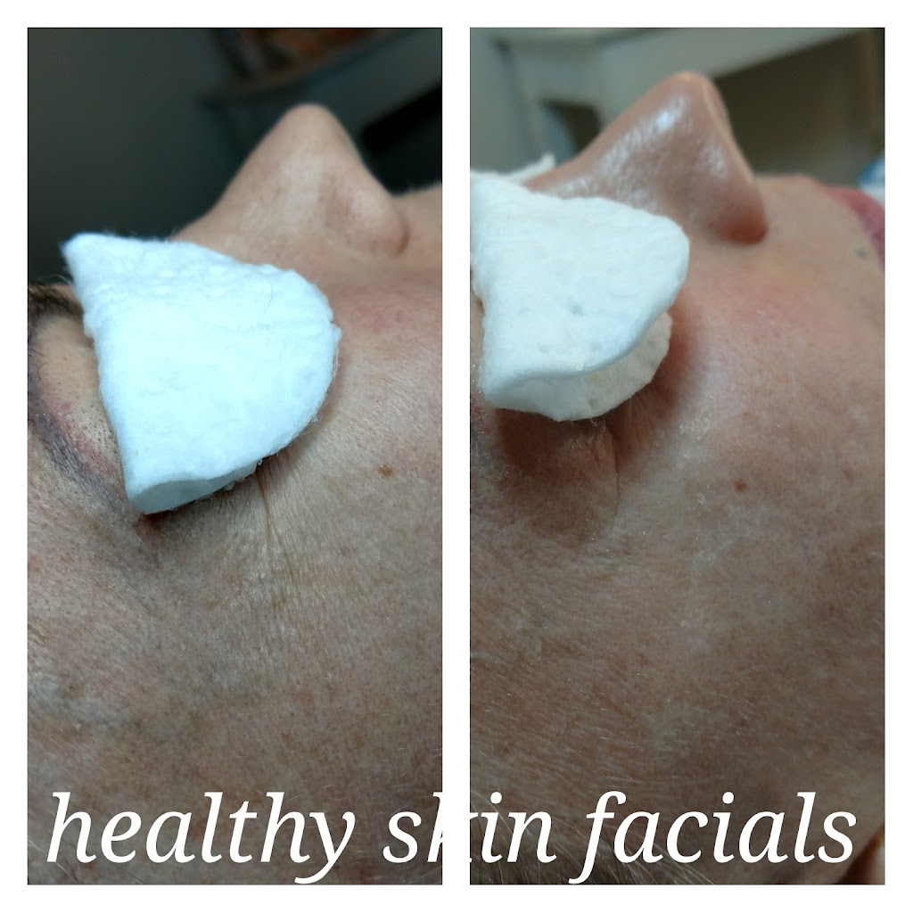 Healthy Skin Facials | 525 4th St N, Jacksonville Beach, FL 32250, USA | Phone: (904) 610-1364