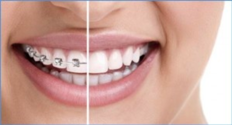 JM Dierkes Orthodontics & TMJ | 910 Marietta Hwy Suite 200, Roswell, GA 30075, USA | Phone: (678) 352-0919