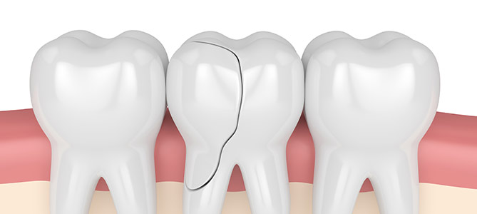 Selective Dental | 3151 S White Rd #203, San Jose, CA 95148, USA | Phone: (408) 763-5514