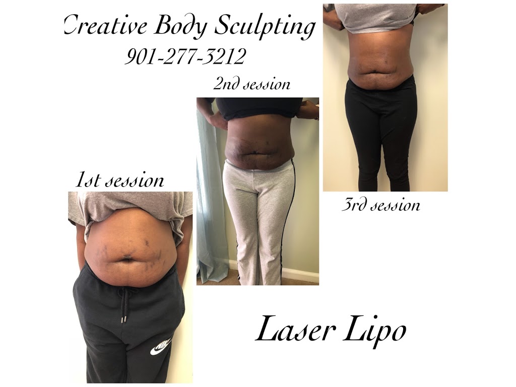 Creative Body Sculpting, LLC | 855 Willow Tree Cir Suite 202, Cordova, TN 38018 | Phone: (901) 277-3212