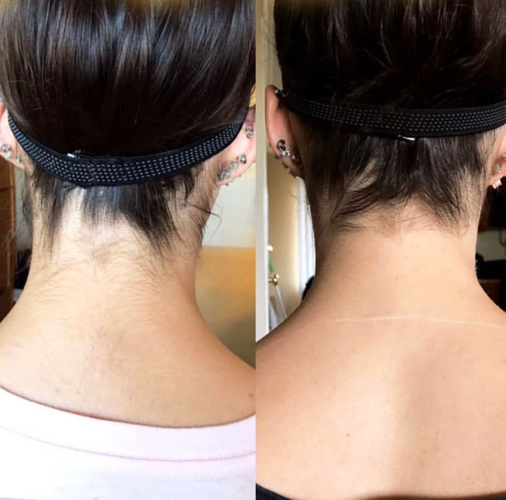 SEV Laser | 2222 Michelson Dr #242, Irvine, CA 92612, USA | Phone: (949) 536-5389