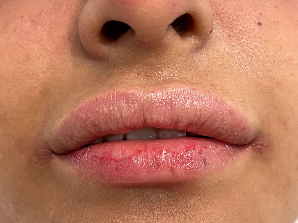 1Aesthetic | 1200 Ave at Port Imperial, Weehawken Township, NJ 07086, USA | Phone: (201) 313-8899