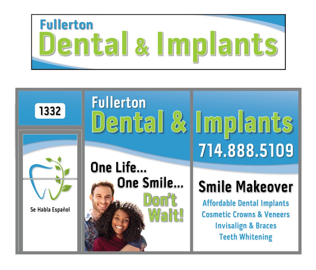 Fullerton Dental & Implants | 1332 E Chapman Ave, Fullerton, CA 92831, USA | Phone: (714) 888-5109